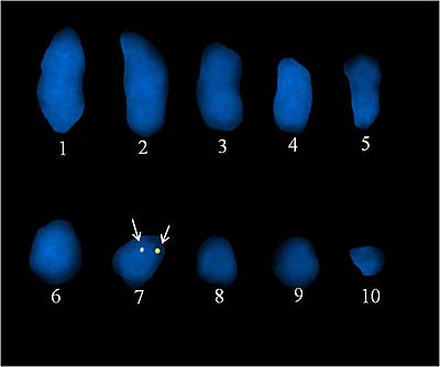 写真２　マツノマダラカミキリの染色体上に存在するボルバキアの遺伝子