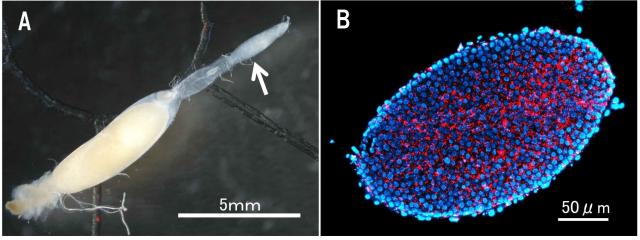 左側ビロウドカミキリの卵巣の一部と右側ボルバキアの存在がわかる画像