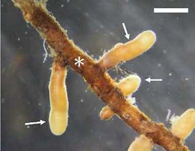 写真右：根に共生する菌根菌の様子