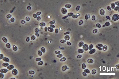 ヨツスジハナカミキリの共生器官に入っていた酵母の画像