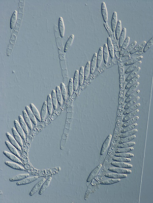 写真2：スタキリナ・フィロリコラ（Stachylina philoricola）